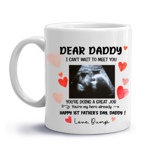 Happy 1st Father’s Day Daddy I Can’t Wait To Meet You Mug, Father’s Day Gift Gift From Unborn Baby, Baby Scan Photo Mug, Expecting Dad Gift